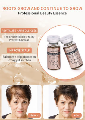 La mejor calidad de cuidado contra la pérdida del cabello Tratamiento Cuidado del cuero cabelludo Prevenir la pérdida del cabello Suero de crecimiento del cabello
