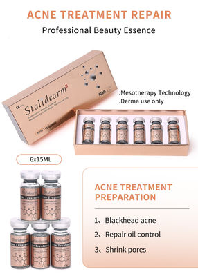 Mejor producto para el tratamiento del acné facial Elimina el acné Pele lisa y reduce los poros Suero aclarador Esencia blanqueadora