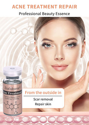 Mejor producto para el tratamiento del acné facial Elimina el acné Pele lisa y reduce los poros Suero aclarador Esencia blanqueadora