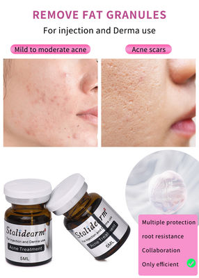 Suero de Exosomas France Stalidearm Skin Booster Suero de Mesoterapia Inyectable para el Tratamiento del Acné
