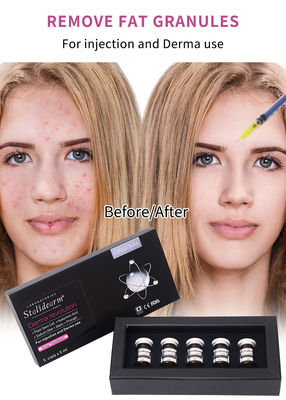 Suero de Exosomas France Stalidearm Skin Booster Suero de Mesoterapia Inyectable para el Tratamiento del Acné