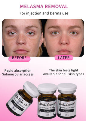 Conjunto de inyección de 5 ml de suero anti-melasma líquido con personalización OEM