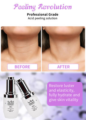 Conjunto de suero de exfoliación facial de calidad profesional para solución de peeling de piel
