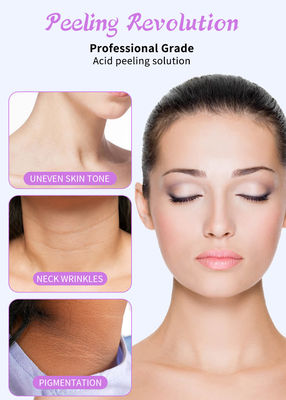 Conjunto de suero de exfoliación facial de calidad profesional para solución de peeling de piel