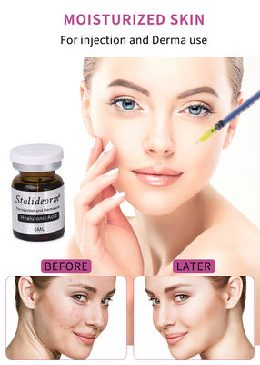 Stalidearm ácido hialurónico suero facial inyectable para el mejoramiento de la piel y la mesoterapia