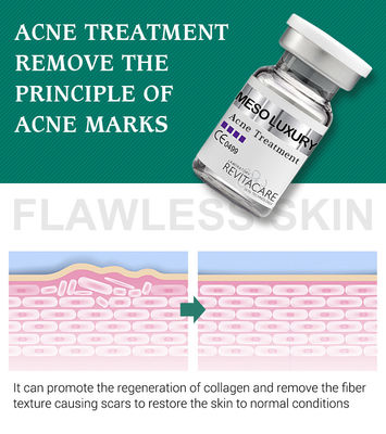 Suero claro de la espinilla pura de la planta que blanquea el tratamiento Mesotherapy para las cicatrices del acné