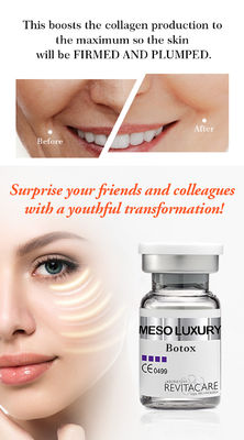 blanquear el suero MESO de Mesotherapy del suero de Microneedling del suero de BOTOX para la cara
