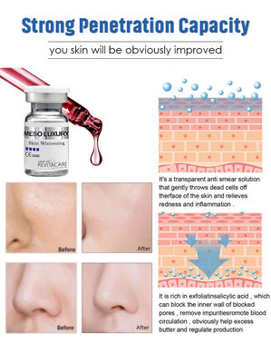 El suero meso DE LUJO Microneedling absorbió inmediatamente la piel que blanqueaba la esencia 10ML