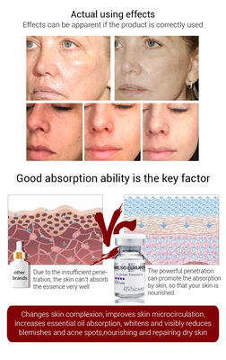Aligeramiento consolidando el suero meso de la esencia del caviar de Microneedling Mesotheraphy del suero