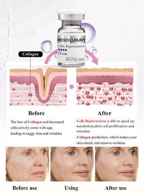Célula meso que rejuvenece el suero Microneedling antienvejecedor del poder para blanquear de la piel