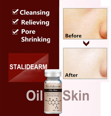 Microneedle Serum Mesoterapia Ance Tratamiento Anti Acné Etiqueta personalizada Pluma Dermal Esencia de la cara para la piel grasa