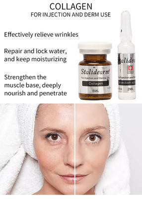 Solución inyectable de mesoterapia de colágeno Exosome Skin Booster Relleno dérmico