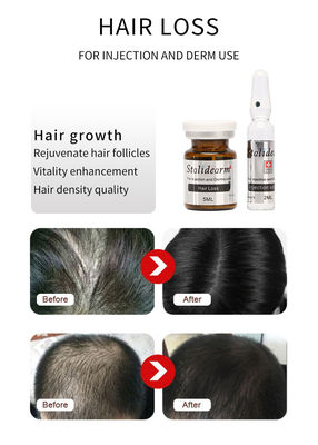 Suero de exosoma capilar inyectable France Original Stalidearm Solución de mesoterapia para el crecimiento del cabello