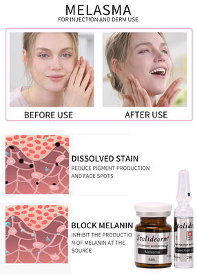 Caja fuerte del suero del uso de la inyección de Melasma y buen sistema del suero de Mesotherapy 5ml/bottle del efecto