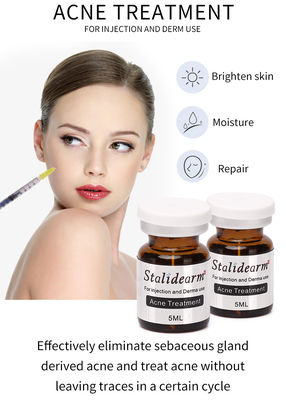 Tratamiento del acné con exosomas Solución de mesoterapia Botox para el refuerzo de la piel