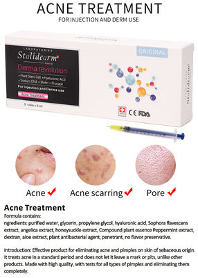 La inyección del suero de la esencia del tratamiento del acné utiliza Theraphy meso que el buen suero seguro del efecto fijó 5pcs/Set