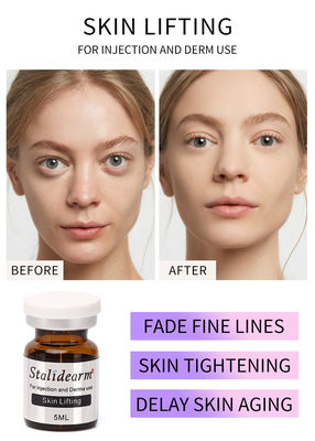 Solución inyectable de mesoterapia Stalideram Exosomes Skin Booster Anti-Edad para levantar la piel
